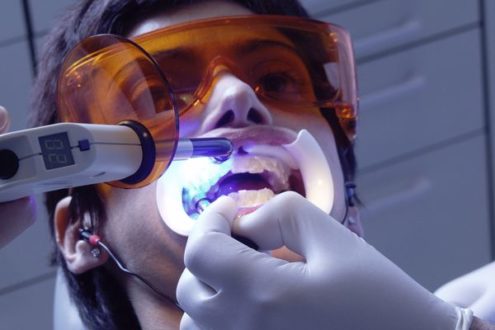 Отбеливание зубов цена