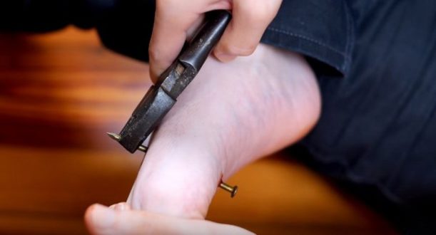 Какие бывают раны?