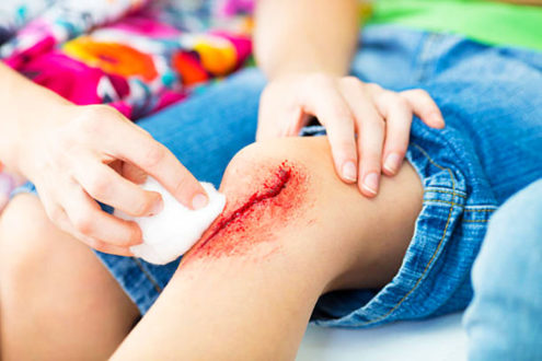 Какие бывают раны?