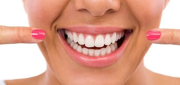 белоснежная улыбка