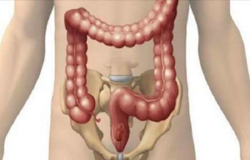 Хронический запор - диагностируем и лечим