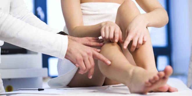 Консультация флеболога