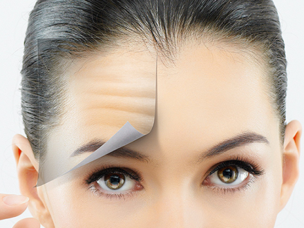 Брови после ботокса: только без паники!