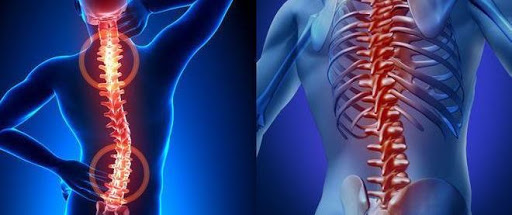 Профилактика и лечение заболеваний позвоночника