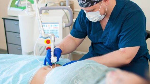 Особенности удаления растяжек лазером