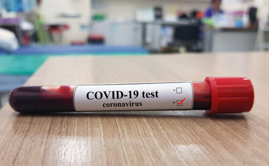 Медицинские анализы в сети лабораторий «Сдать анализы»