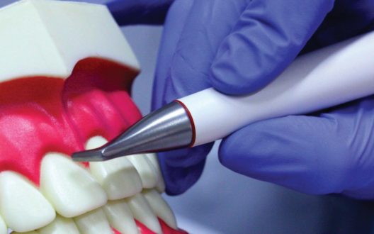 Чистка зубов с помощью Air Flow - особенности и преимуществ