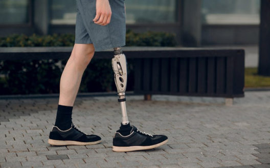 Бесплатный протез ноги