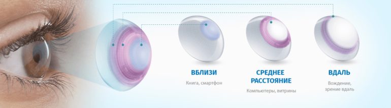 Квартальные линзы - особенности выбора