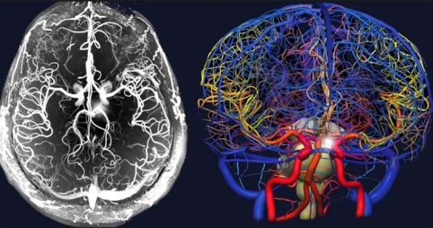 Раскрытие тайн мозга: сила МРТ с контрастом