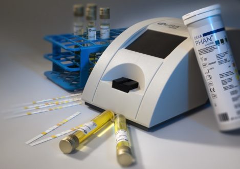 Що таке аналізатор сечі та як його використовують