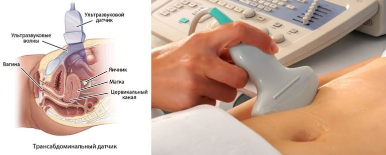 Яким буває УЗД і де його можна зробити