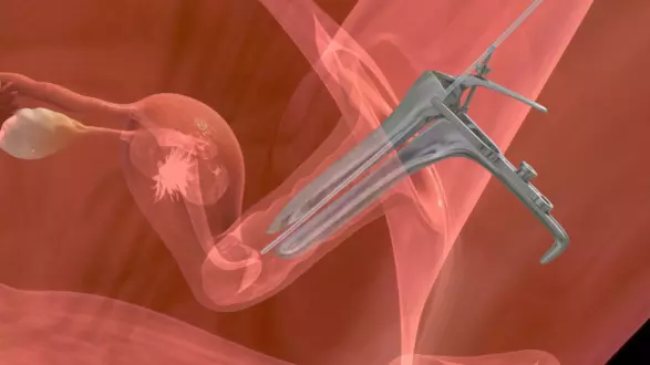 Запліднення – метод ІКСІ – нюанси, переваги