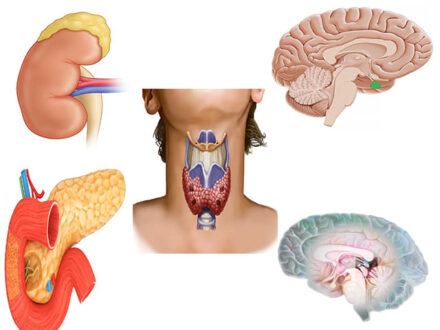 Ендокринні захворювання – у яких випадках потрібен ендокринолог?