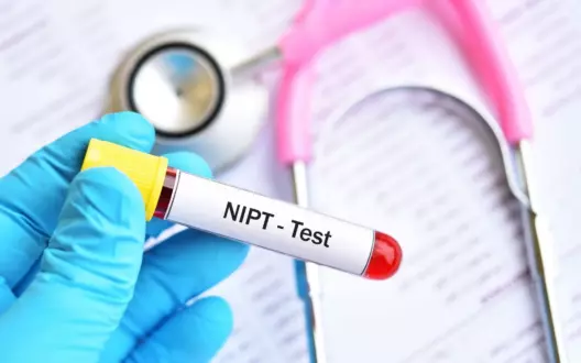 Анализ НИПТ: современные методы определения генетических отклонений на этапе беременности