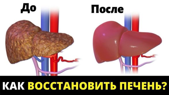 Как понять, что нужно восстановление печени и как эффективно это сделать