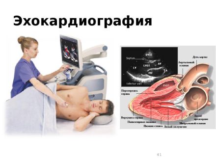Эхокардиография (УЗИ сердца): что это, показания и как проводится