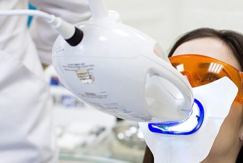 Отбеливание зубов Zoom 4: эффективное решение для сияющей улыбки