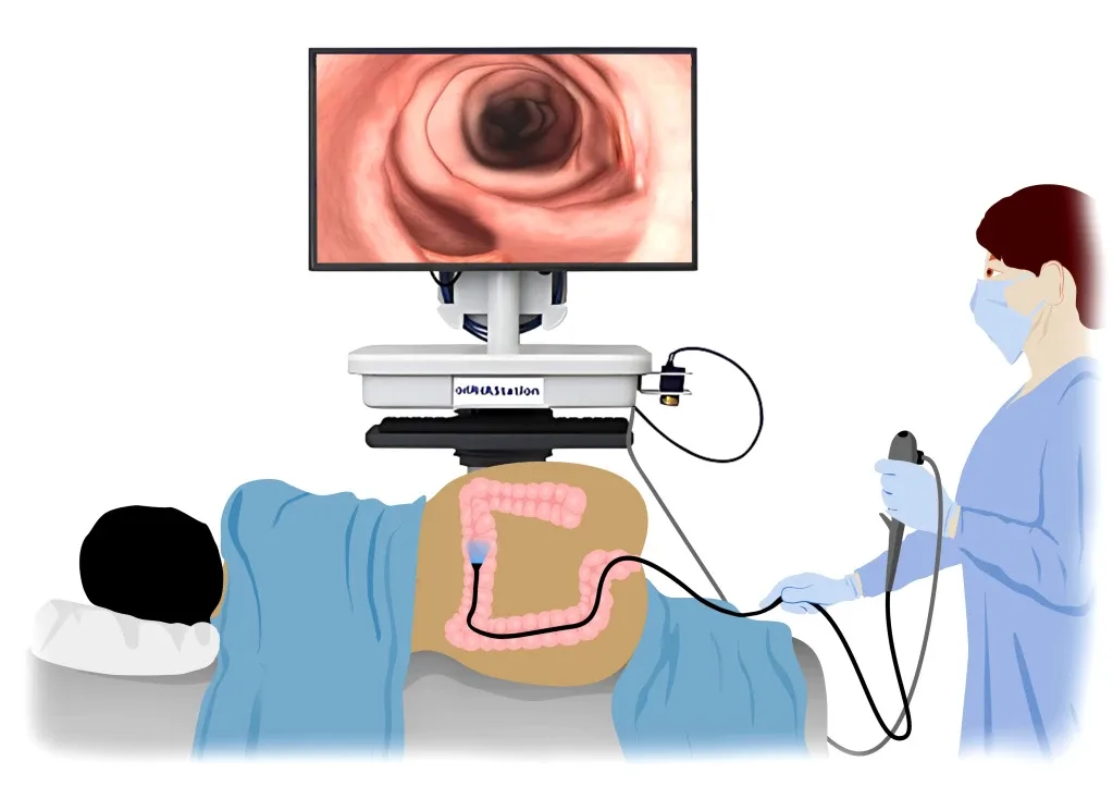 Колоноскопия (ФКС): точная диагностика кишечника в комфортных условиях